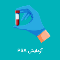 آزمایش PSA